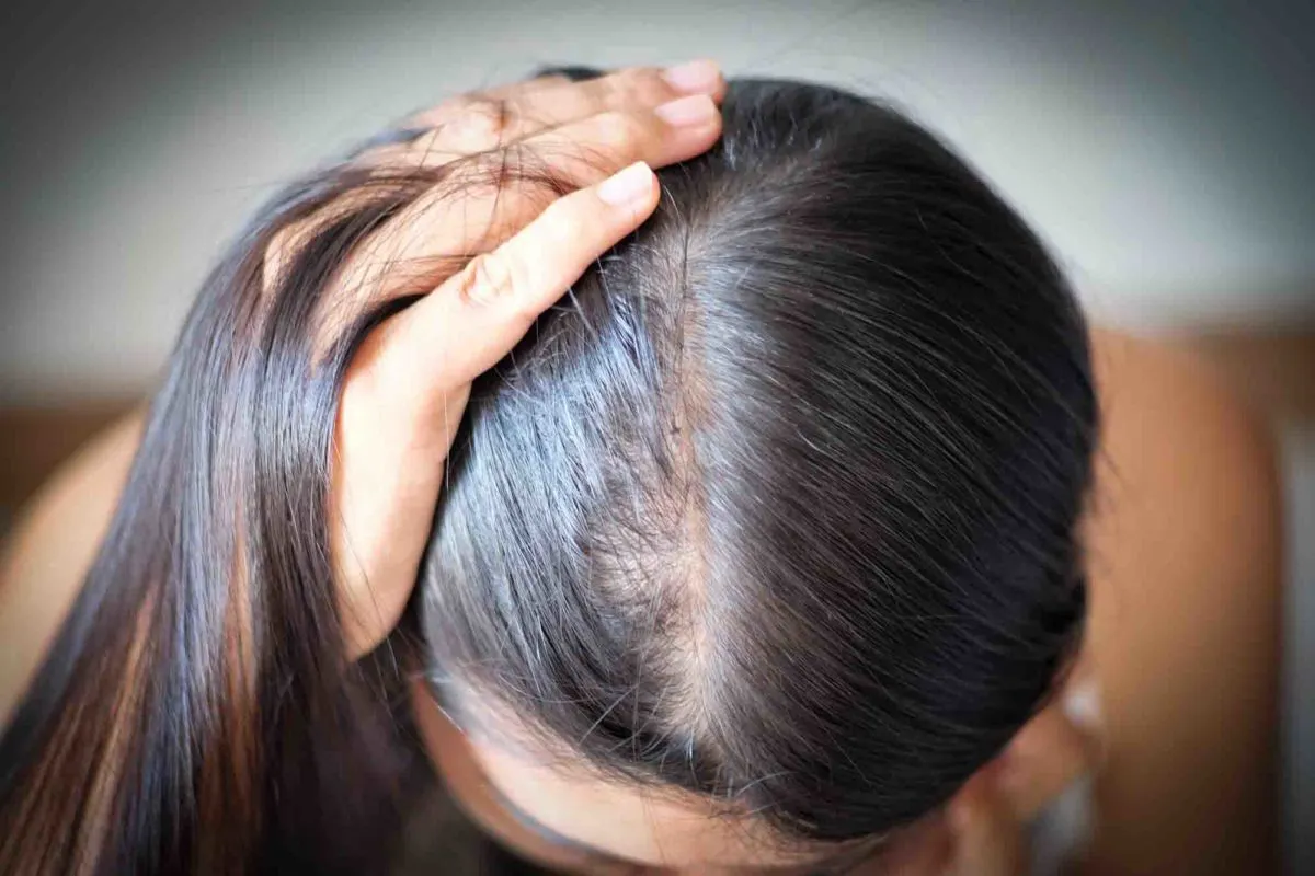 Does Hair Colour Cause Hair Fall? Truth Every Person Should Know