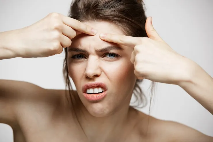 Common Mistakes People Make with Oily Skin