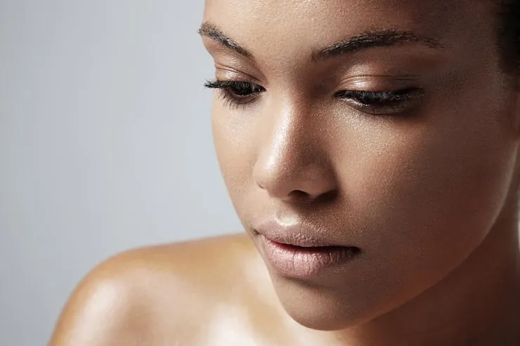 Why Oily Skin Still Needs Moisture